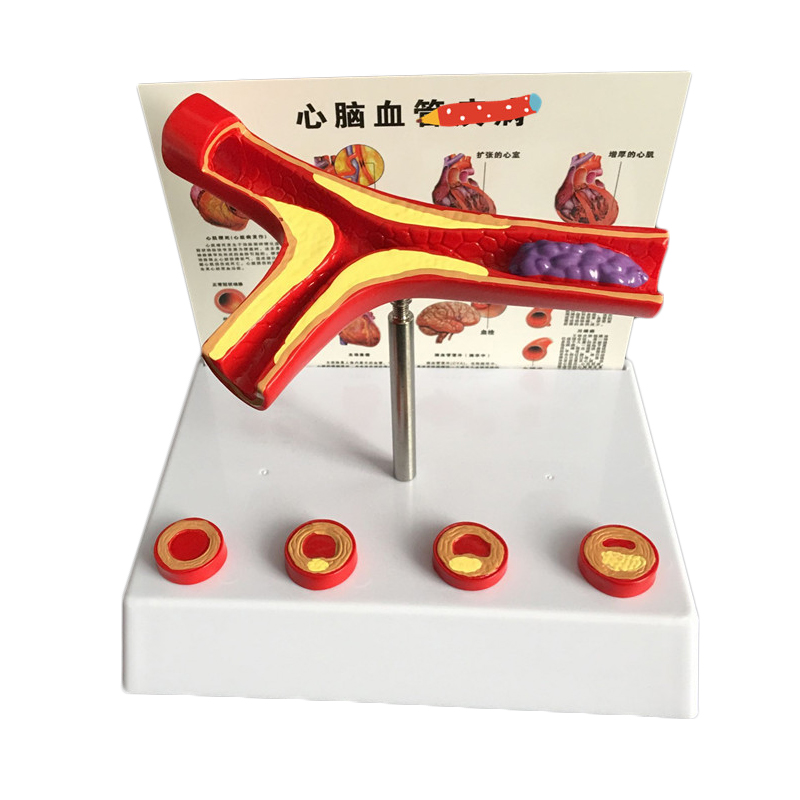 Medical Lab Supplies - Fournitures de laboratoire de modèle vasculaire