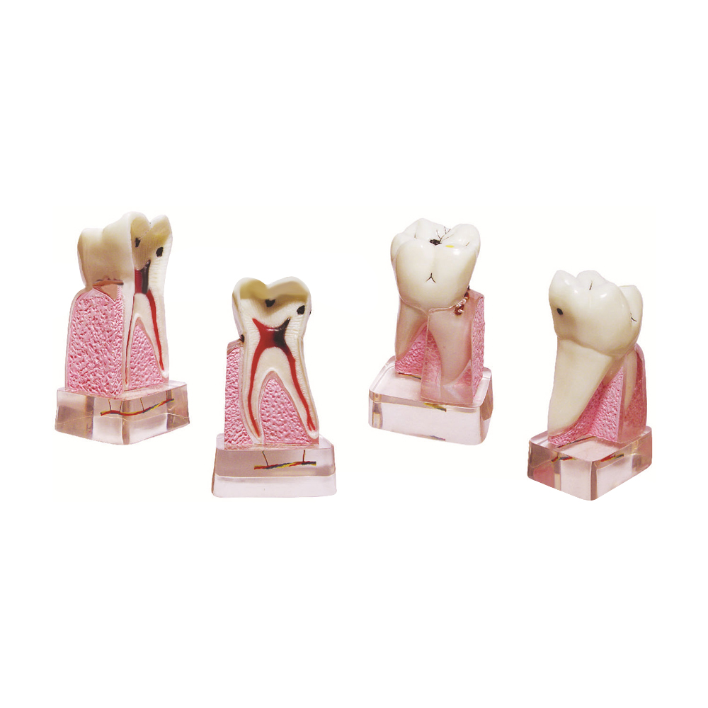 Modèle pathologique dentaire,  - Medical Lab Supplies avis et prix